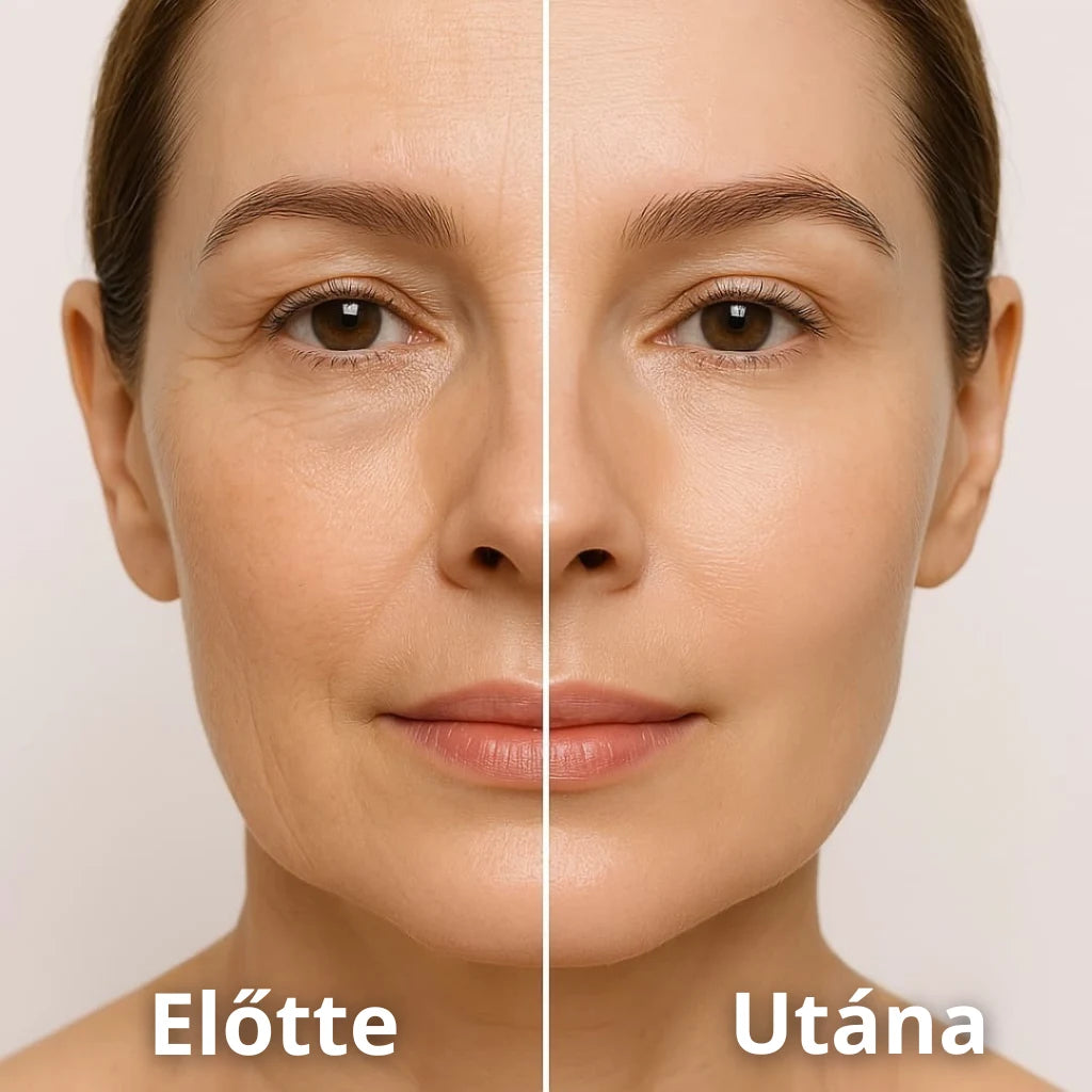 ✨ Vitalis™ – A feszes, sima és ragyogó bőr titka – (1+1 INGYEN)